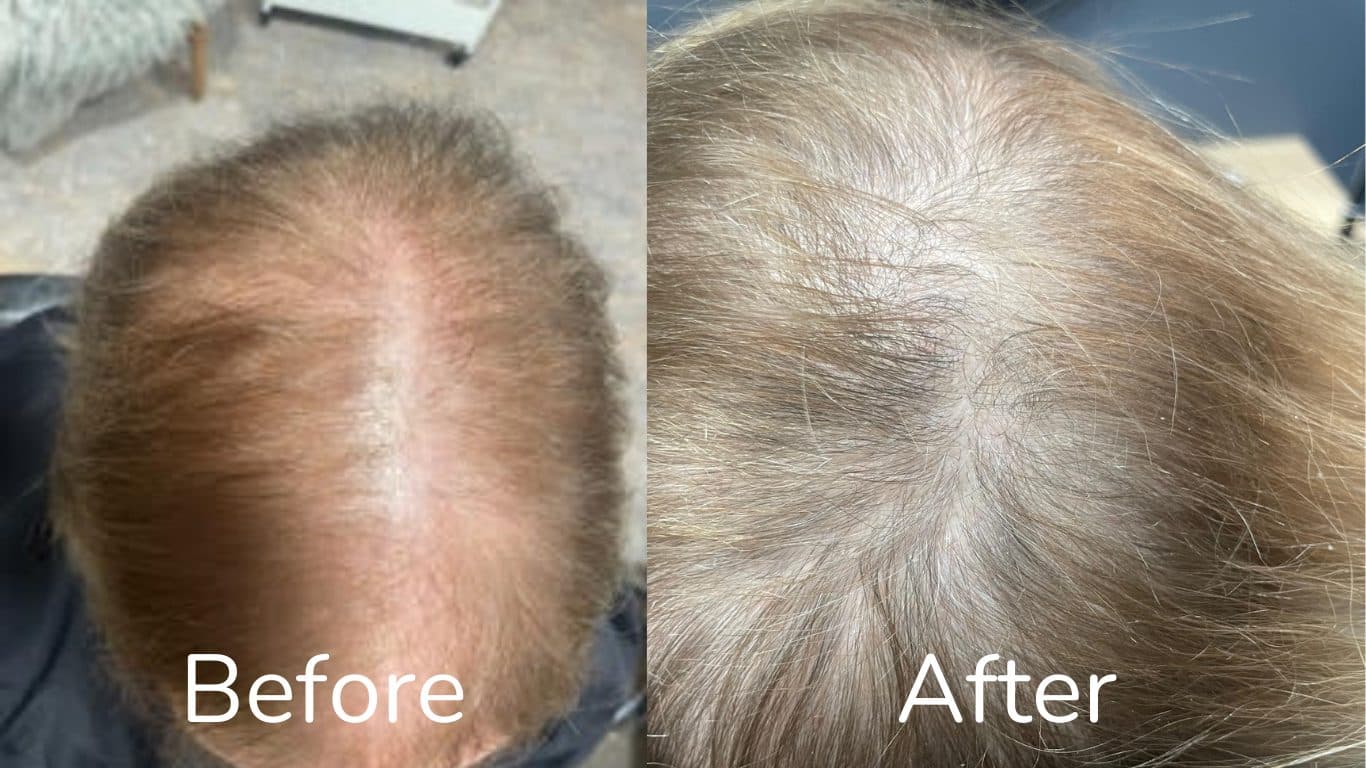 Joanne's hair treatment results