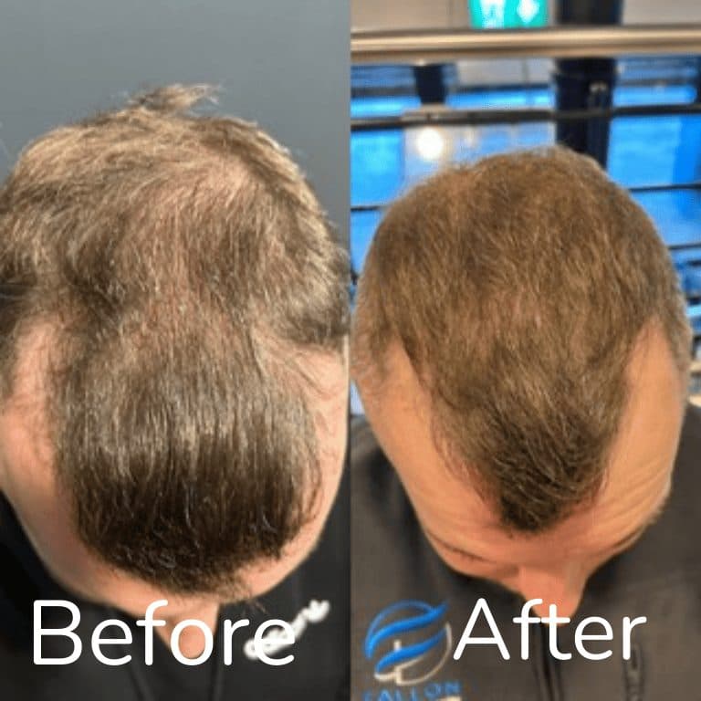 Sean's hair transformation