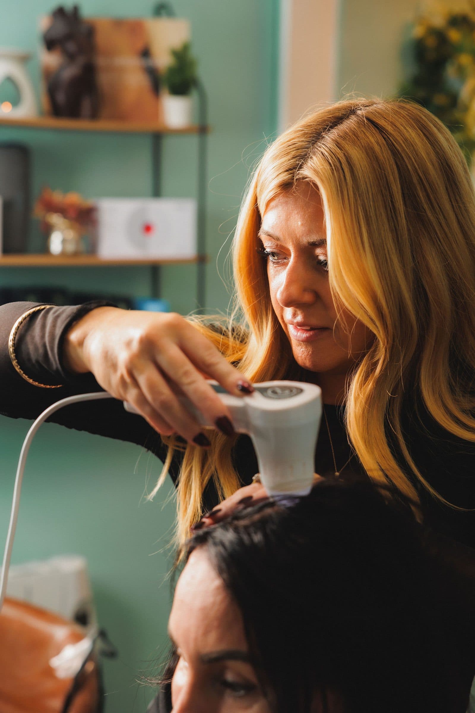 Exosome microneedling scalp treatment at Be-You Hair Clinic, Malahide